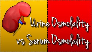 Urine Osmolality vs Serum Osmolality Hyponatraemia [upl. by Deibel]