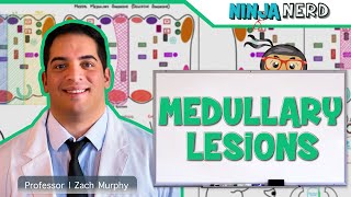 Medullary Lesions Medial and Lateral Medullary Syndromes [upl. by Aicek892]