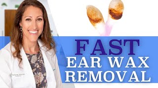 Clogged Ears  How to Remove Ear Wax At Home With Hydrogen Peroxide [upl. by Hun]