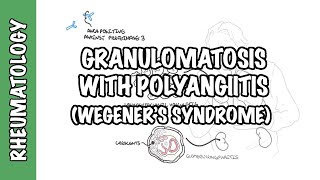 INFLAMMATION Part 9 Chronic Inflammation  GRANULOMATOUS INFLAMMATION [upl. by Hullda928]