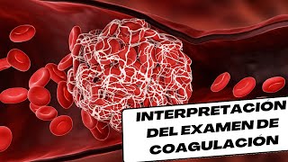 Interpretación de Pruebas de coagulación [upl. by Zanas]