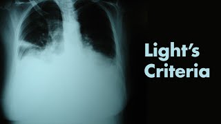 Lights Criteria amp Pleural Effusions  MEDZCOOL [upl. by Tolmach91]