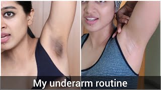 How I Got Rid of My Dark Underarms [upl. by Nyrmac33]