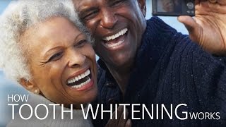 How Tooth Whitening Works [upl. by Yeknarf]