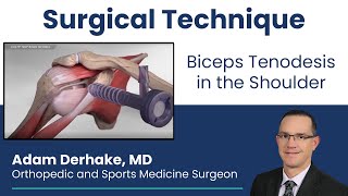 Biceps Tenodesis in the Shoulder Surgical Technique [upl. by Westmoreland724]