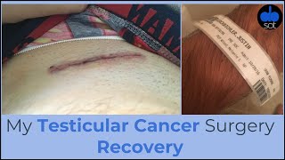 My Testicular Cancer Surgery Recovery [upl. by Waterman791]