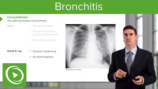 Pulmonary abscess  Respiratory system diseases  NCLEXRN  Khan Academy [upl. by Efinnej]