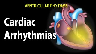 Cardiac Arrhythmias Animation [upl. by Roseanna271]