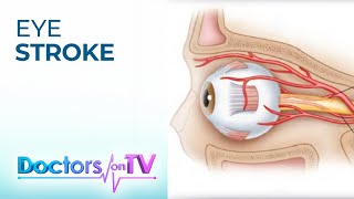 Retina Road to Recovery after Vitrectomy Surgery week 4 [upl. by Strohben]