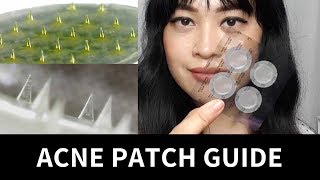 Guide to Acne Patches Hydrocolloid Treatment Microneedle  Lab Muffin Beauty Science [upl. by Vinna]