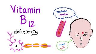 Vitamin B12 Cobalamin Deficiency  Causes Symptoms Diagnosis amp Management  Hematology Series [upl. by Sigfried]