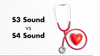 S3 vs S4 Heart Sound [upl. by Buroker]