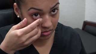 How to Apply Ointment to the Eyes and Eyelids [upl. by Spears]