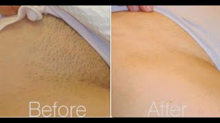 Brazilian Waxing 101 All You Need To knowTips [upl. by Ardisj]