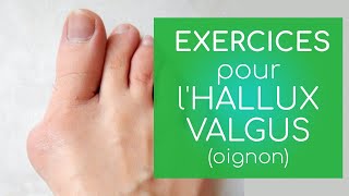 Hallux valgus exercices et infos [upl. by Drahnreb]