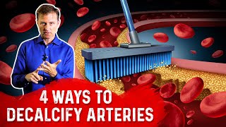 4 Ways To Decalcify Your Arteries – Dr Berg [upl. by Iinde]