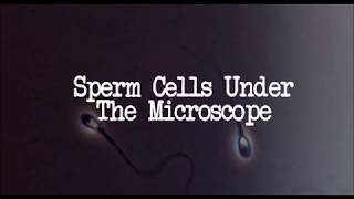 What Are Sperm Cells Sperm Under The Microscope [upl. by Nivlad]