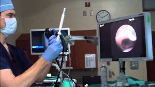 Learn Bronchoscopy from Dr Mehta [upl. by Drofkcor295]