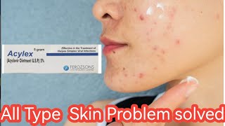 All Type Skin Problem solved ll use just 3 nights Acylex ll easy your life [upl. by Aimej]