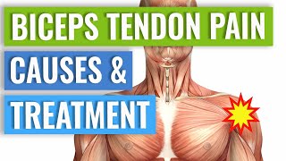 Biceps Tendonitis Treatment and Exercises Explained [upl. by Macdonell581]