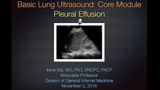 Pleural Effusion [upl. by Hackathorn]