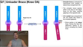 Rebound PostOp Knee – Clinician Fitting instructions [upl. by Ybrad]