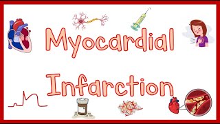 Stroke Syndromes MCA ACA ICA PCA Vertebrobasilar Artery Strokes  Pathophysiology [upl. by Fanchan]