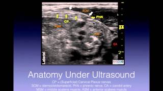 Tutorial Superficial Cervical Plexus Block [upl. by Arerrac135]