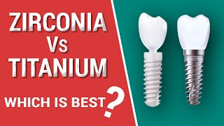 Zirconia Vs Titanium Dental Implants [upl. by Ahsenid]