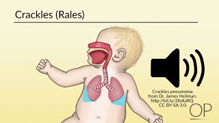 Respiratory Assessment by B Leary L DelSignore  OPENPediatrics [upl. by Boland]