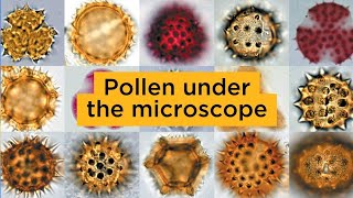 Pollen under the microscope [upl. by Ardnossak]