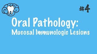 Oral Pathology  Mucosal Immunologic Diseases  INBDE ADAT [upl. by Laise]