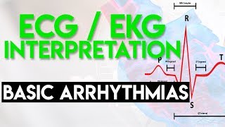 Basic Arrhythmias  Sinus Brady Tachy Premature Beats  ECG EKG Interpretation Part 3 [upl. by Yenreit]