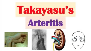 Polyarteritis nodosa  Circulatory System and Disease  NCLEXRN  Khan Academy [upl. by Yliah]