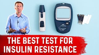 HOMAIR – The Best Insulin Resistance Test – Dr Berg [upl. by Starkey]