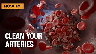 How to Clean your Arteries [upl. by Anasus]