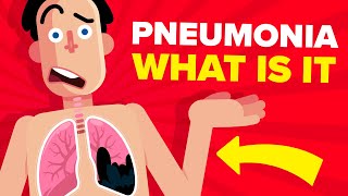 Pneumonia  Explained [upl. by Penland]