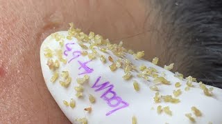 Satisfying With Loan Nguyen Spa Video 027 [upl. by Earley451]