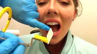 How to Take Periapical Radiographs [upl. by Adon]