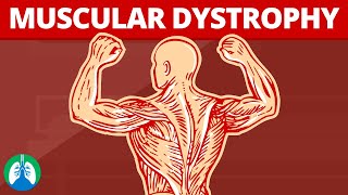 Distúrbios de tônus muscular [upl. by Anaul]