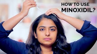 How To Use Minoxidil  Hair Regrowth  Skin Diaries [upl. by Ainomar]