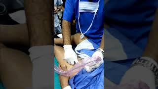 Ultrasound guided suprainguinal fascia iliaca block [upl. by Aseuqram]