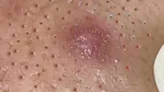 Satisfying With Loan Nguyen Spa Video 009 [upl. by Parrnell]