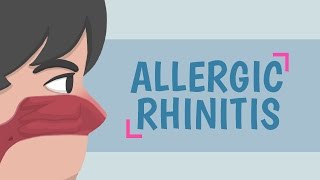 What is Allergic Rhinitis [upl. by Ynnattirb]