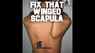 Winged Scapula Repair Protocol  Trevor Bachmeyer  SmashweRx [upl. by Browne]