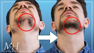 How To Fix Your Patchy Beard… Fast [upl. by Sayette]