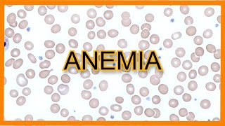 Immune Hemolytic Anemia intro [upl. by Yanrahc]