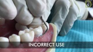 Dentiscope  How to use supragingival scalers [upl. by Cordula]