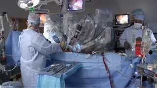 CSection Scar Tissue Removal  Procedure Part 5  David Ghozland MD [upl. by Hermon358]