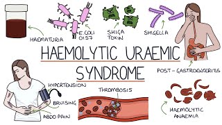 Haemolytic Uraemic Syndrome [upl. by Idell]